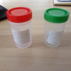urine and stool containers Kenya