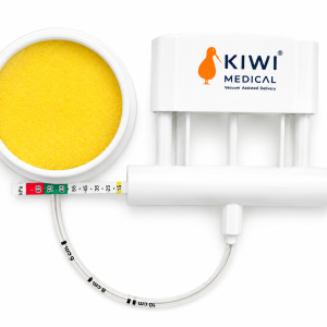 Kiwi Vacuum Delivery System.